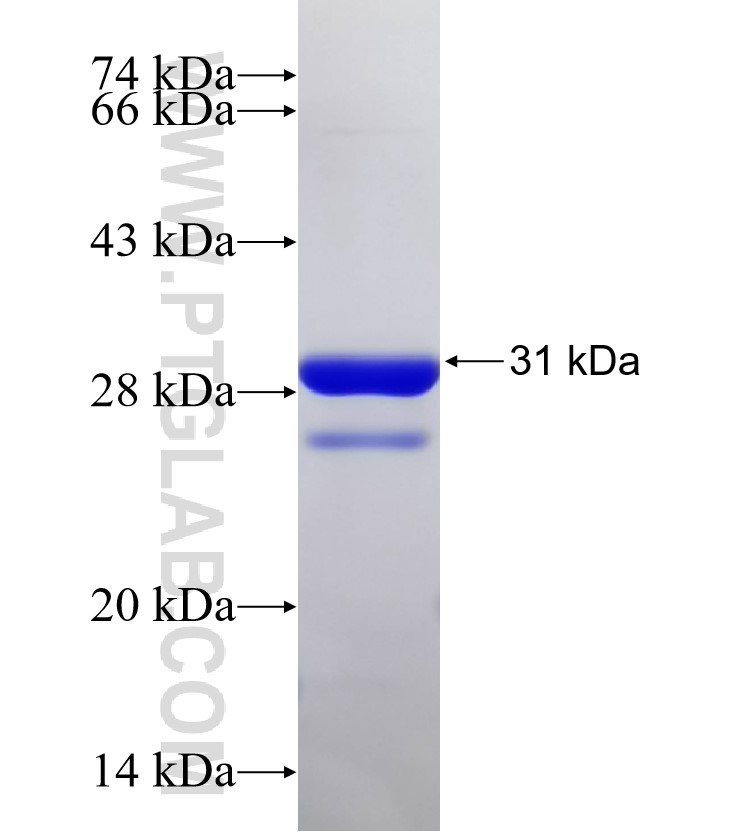 Serine fusion protein Ag32753 SDS-PAGE Serine fusion protein Ag32753 SDS-PAGE