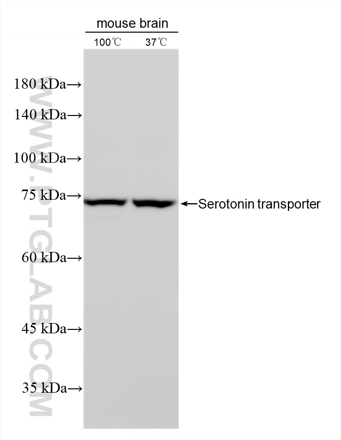 WB analysis of mouse brain using 84844-3-RR