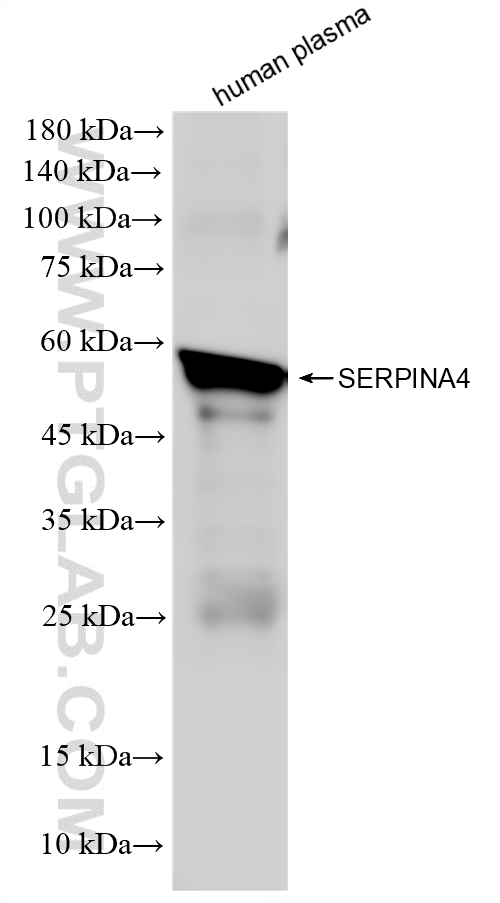 WB analysis of human plasma using 86758-3-RR (same clone as 86758-3-PBS)