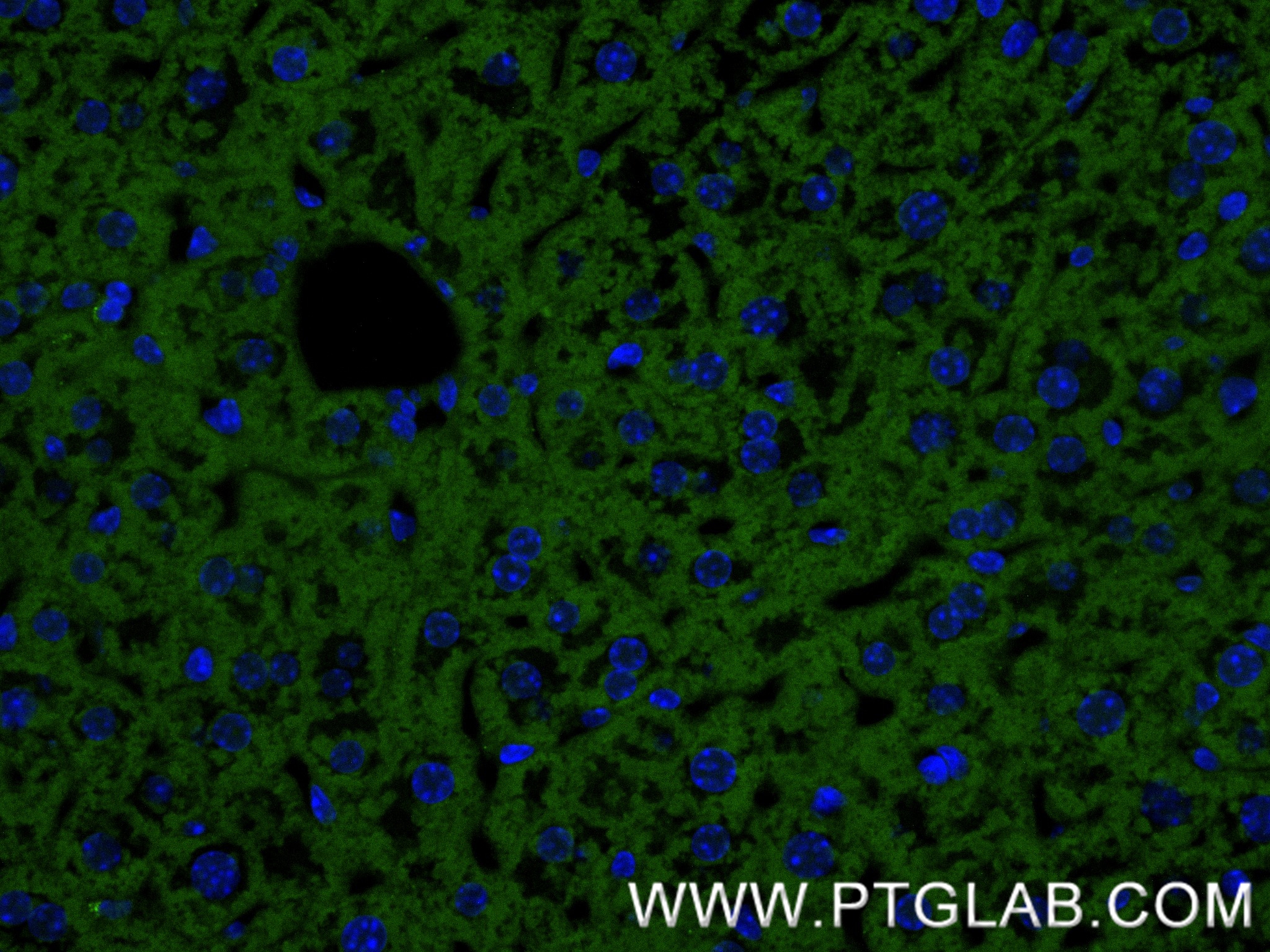 IF Staining of mouse liver using 86067-4-RR IF Staining of mouse liver using 86067-4-RR