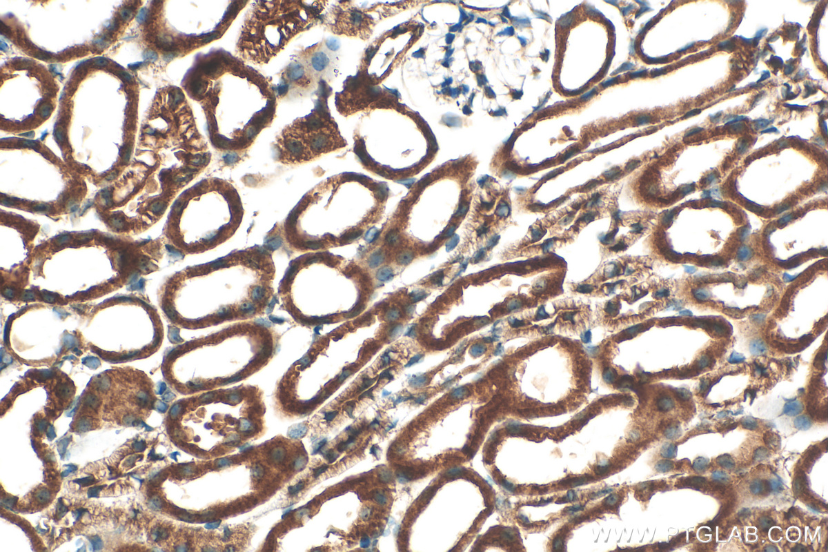 IHC staining of mouse kidney using 55353-1-AP
