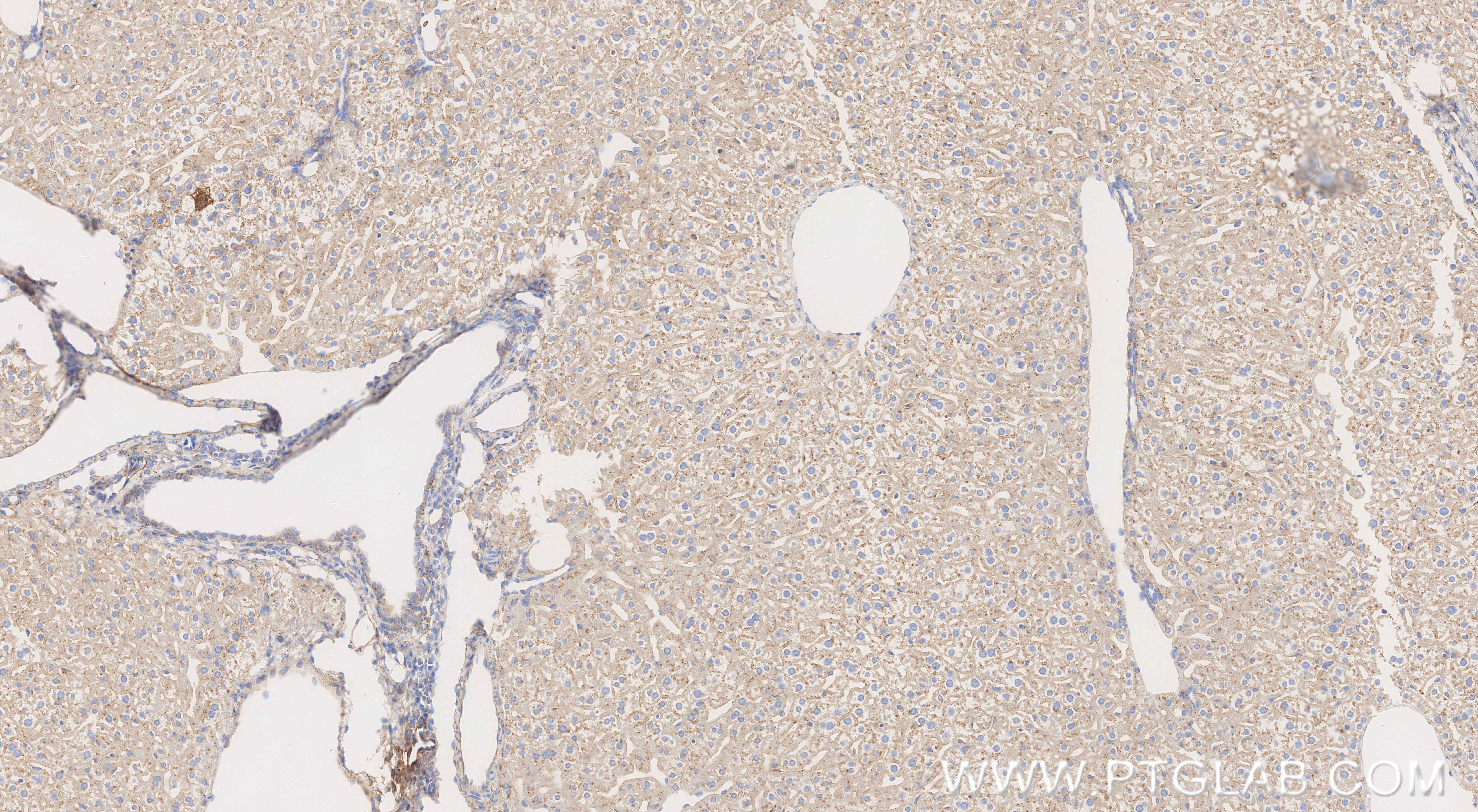 Immunohistochemical analysis of paraffin-embedded mouse liver tissue slide using 86029-1-RR (Serpinc1 antibody) at dilution of 1:1000 (under 10x lens). Heat mediated antigen retrieval with Tris-EDTA buffer (pH 9.0). IHC staining of mouse liver using 86029-1-RR