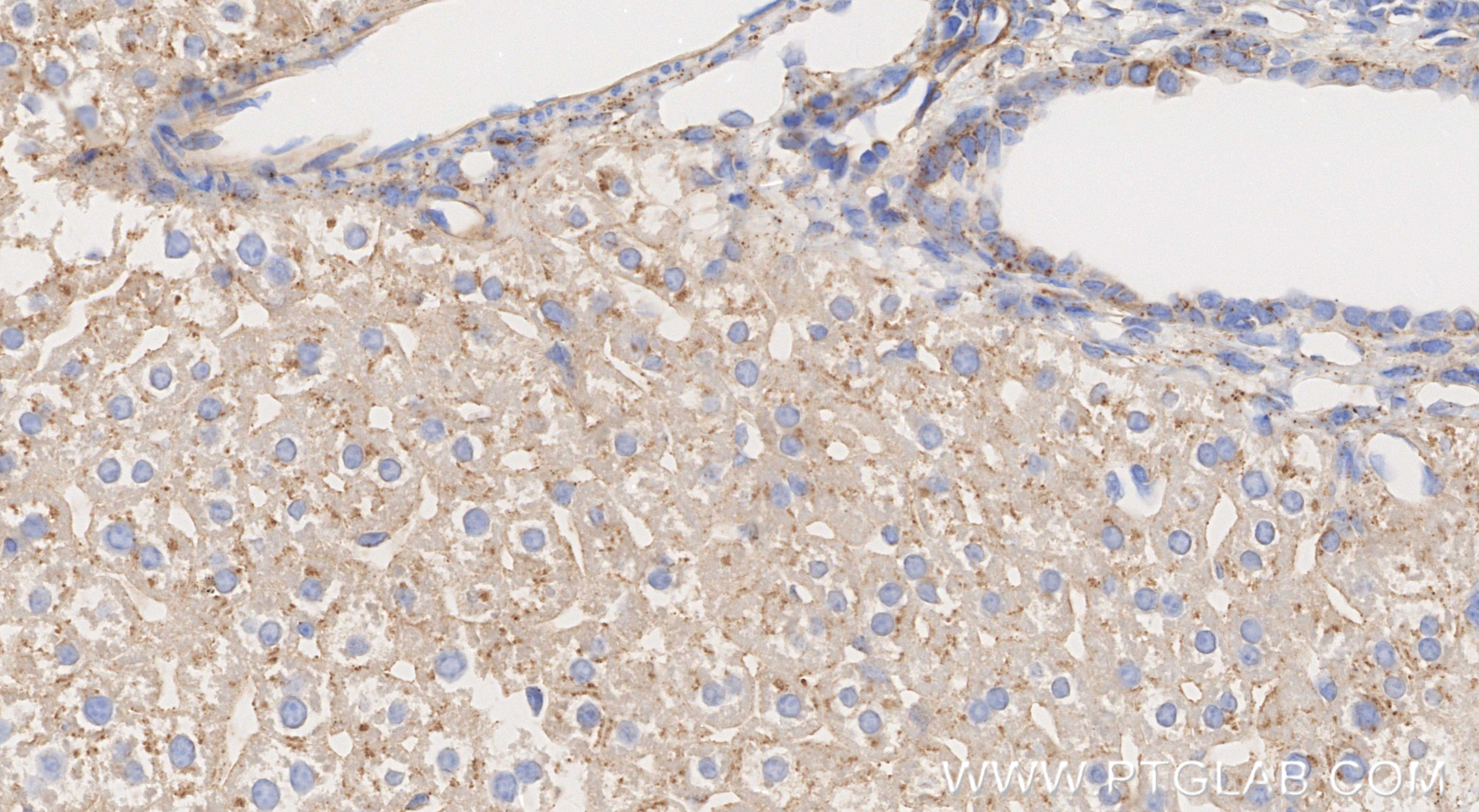 Immunohistochemical analysis of paraffin-embedded mouse liver tissue slide using 86029-1-RR (Serpinc1 antibody) at dilution of 1:1000 (under 40x lens). Heat mediated antigen retrieval with Tris-EDTA buffer (pH 9.0). IHC staining of mouse liver using 86029-1-RR