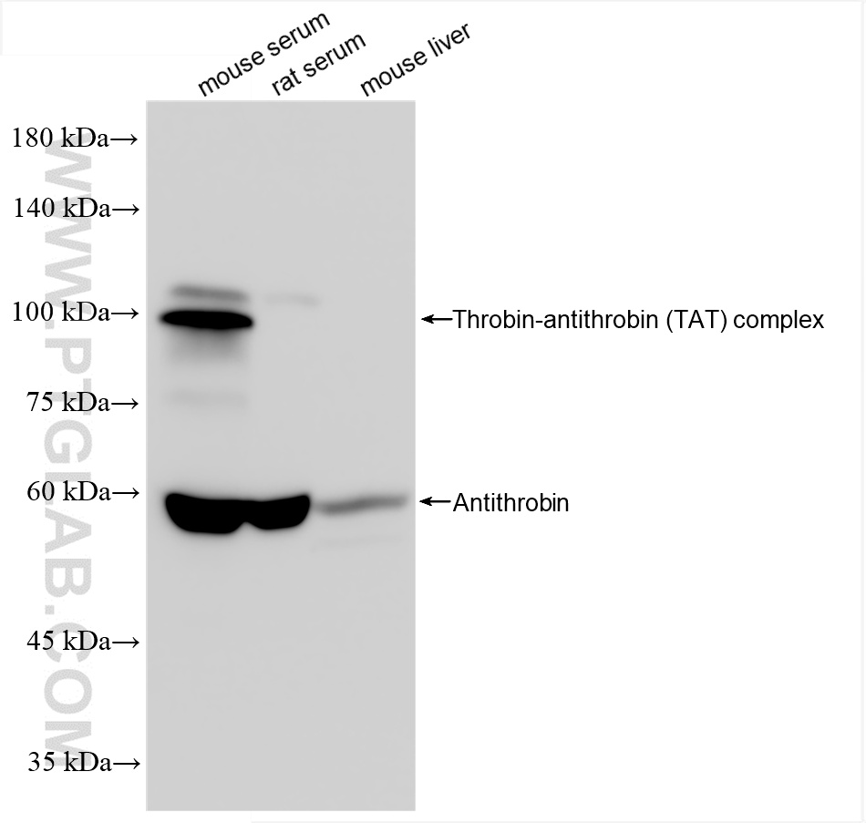 WB analysis using 86029-1-RR