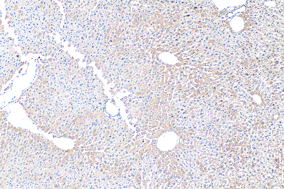 IHC staining of mouse liver using 31813-1-AP