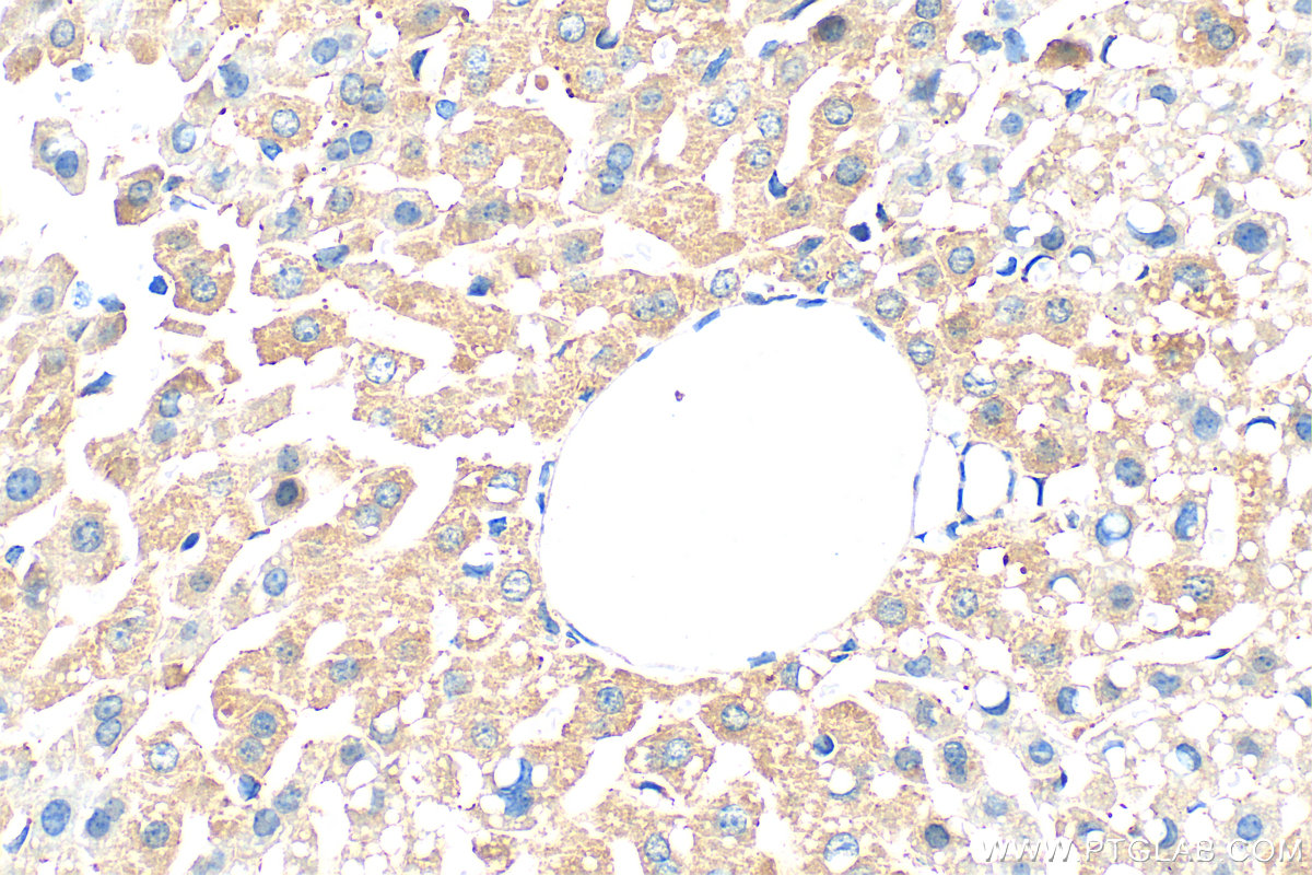 IHC staining of mouse liver using 31813-1-AP