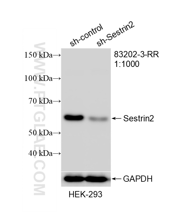 WB result of Sestrin 2 antibody (83202-3-RR; 1:1000; incubated at room temperature for 1.5 hours) with sh-Control and sh-Sestrin 2 transfected HEK-293 cells. WB analysis of HEK-293 using 83202-3-RR