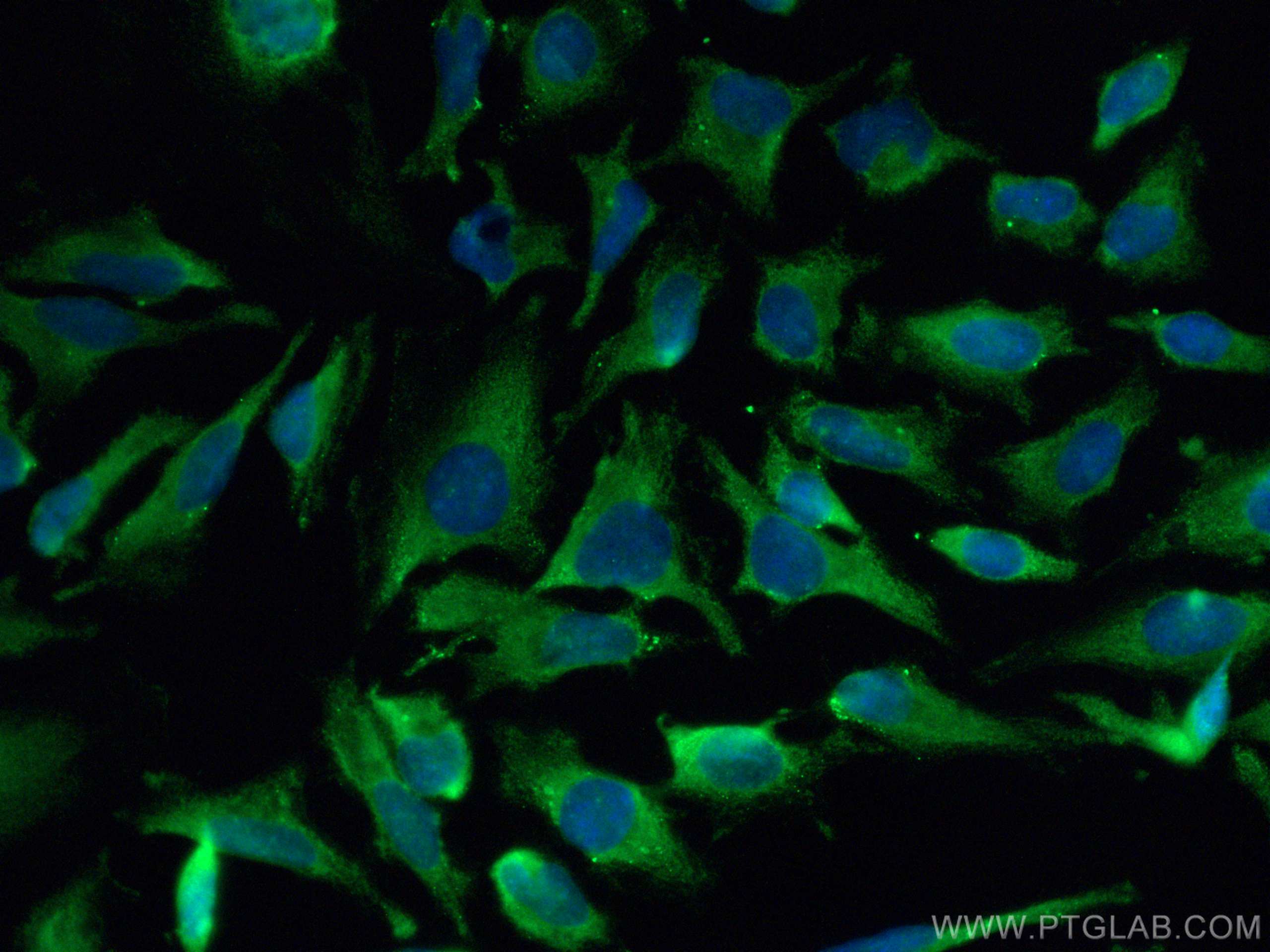 IF Staining of HeLa using CL488-10795