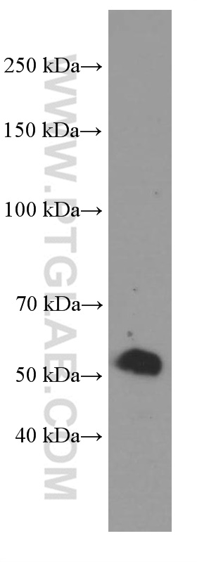 Sestrin 2