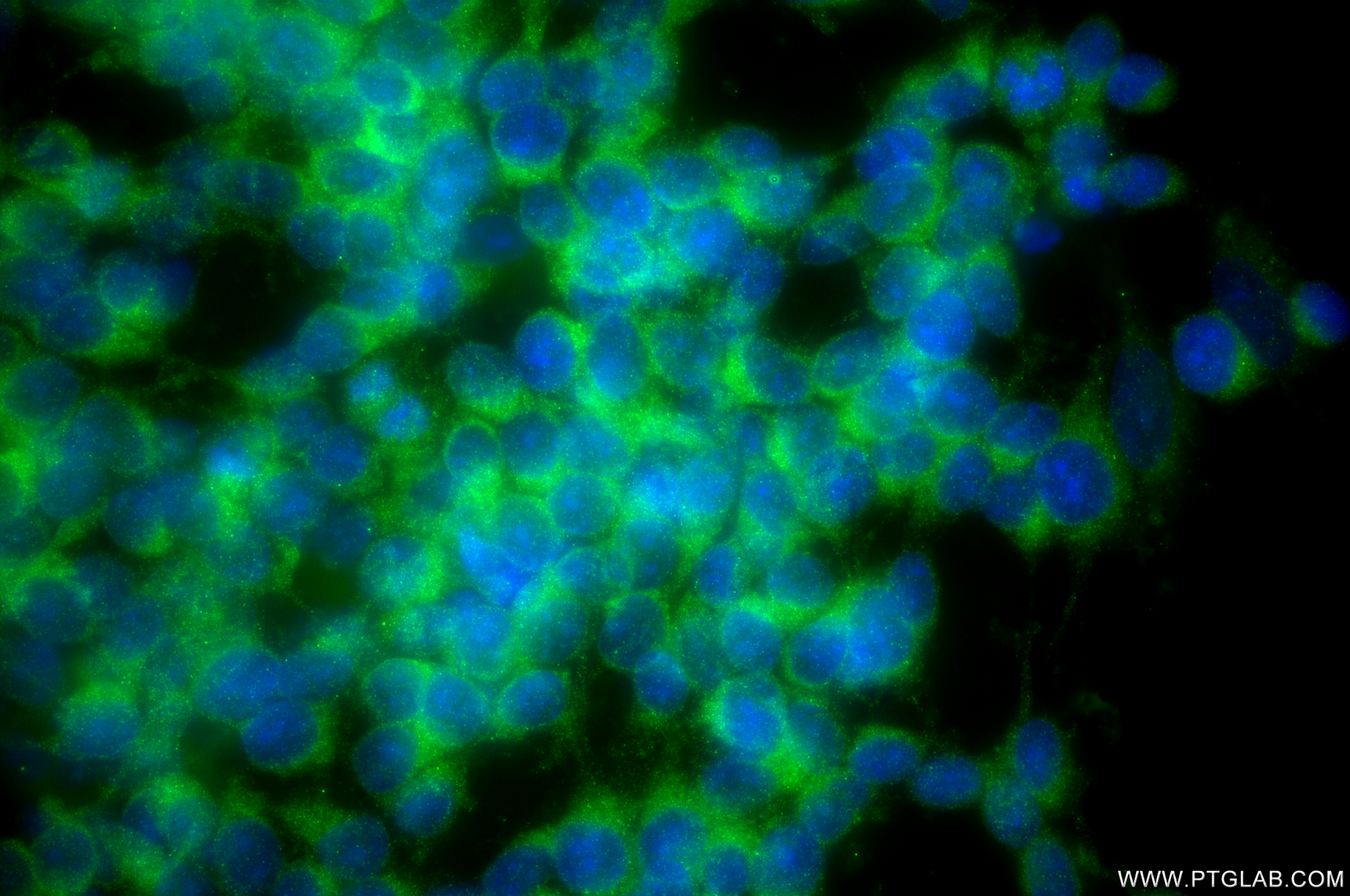 IF Staining of SH-SY5Y using 86541-2-RR (same clone as 86541-2-PBS) IF Staining of SH-SY5Y using 86541-2-RR (same clone as 86541-2-PBS)