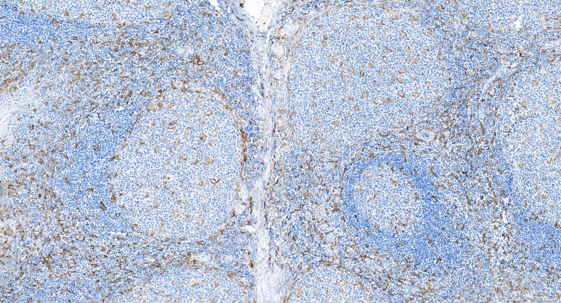 IHC staining of human tonsillitis using 84253-4-RR