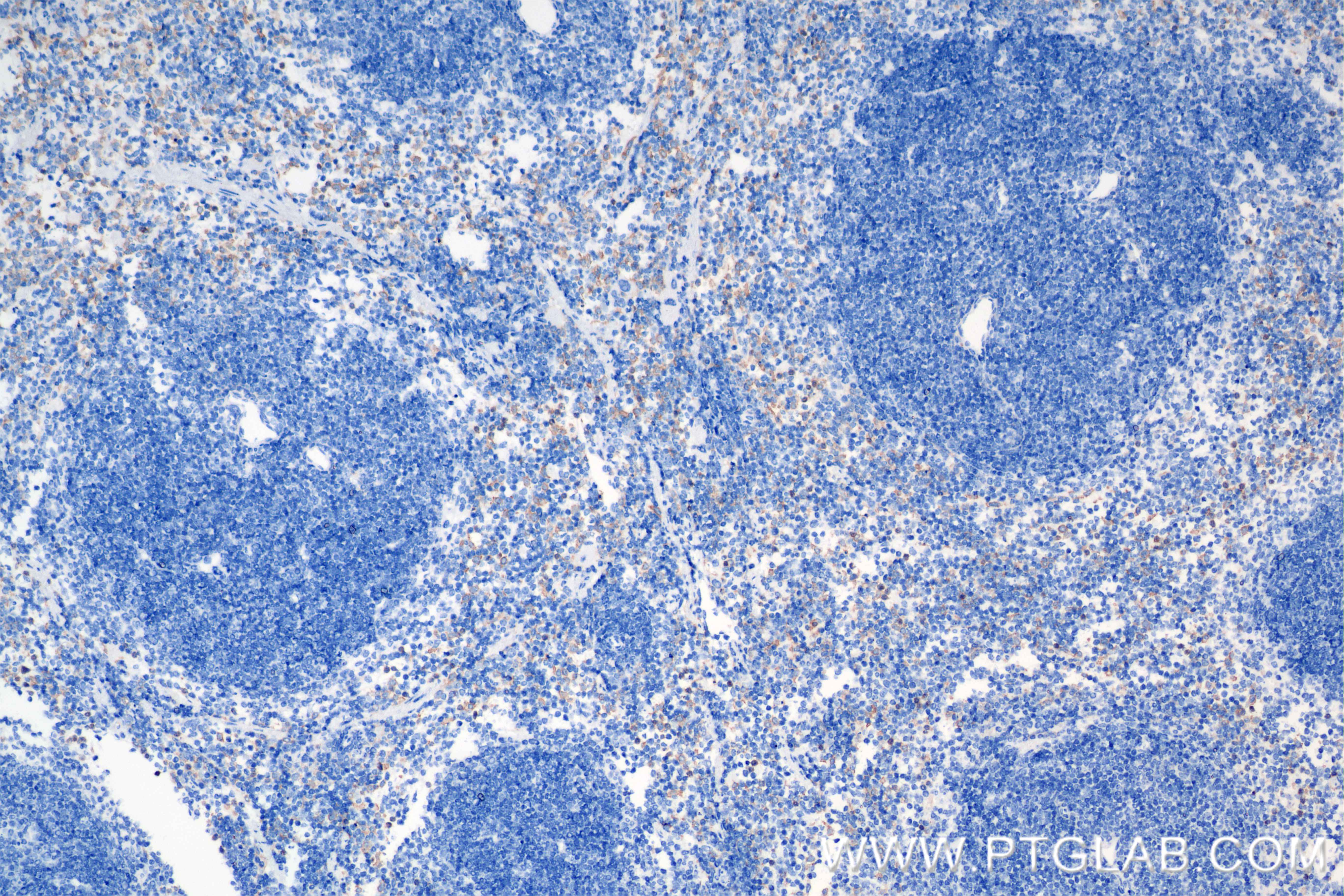 IHC staining of mouse spleen using 84790-2-RR (same clone as 84790-2-PBS)