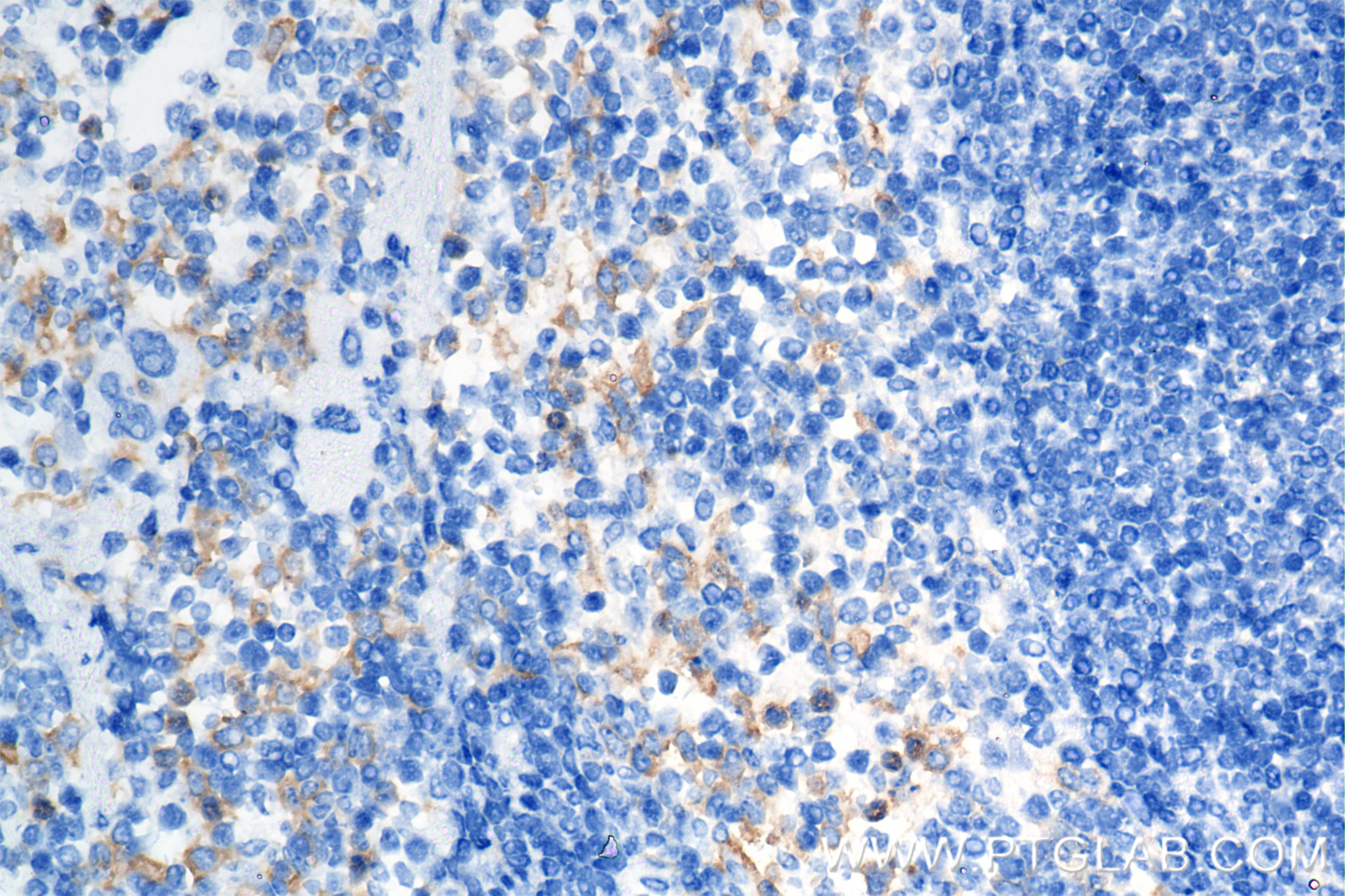 IHC staining of mouse spleen using 84790-2-RR (same clone as 84790-2-PBS)