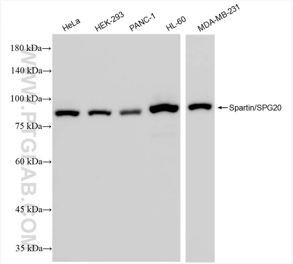 WB analysis using 85938-2-RR
