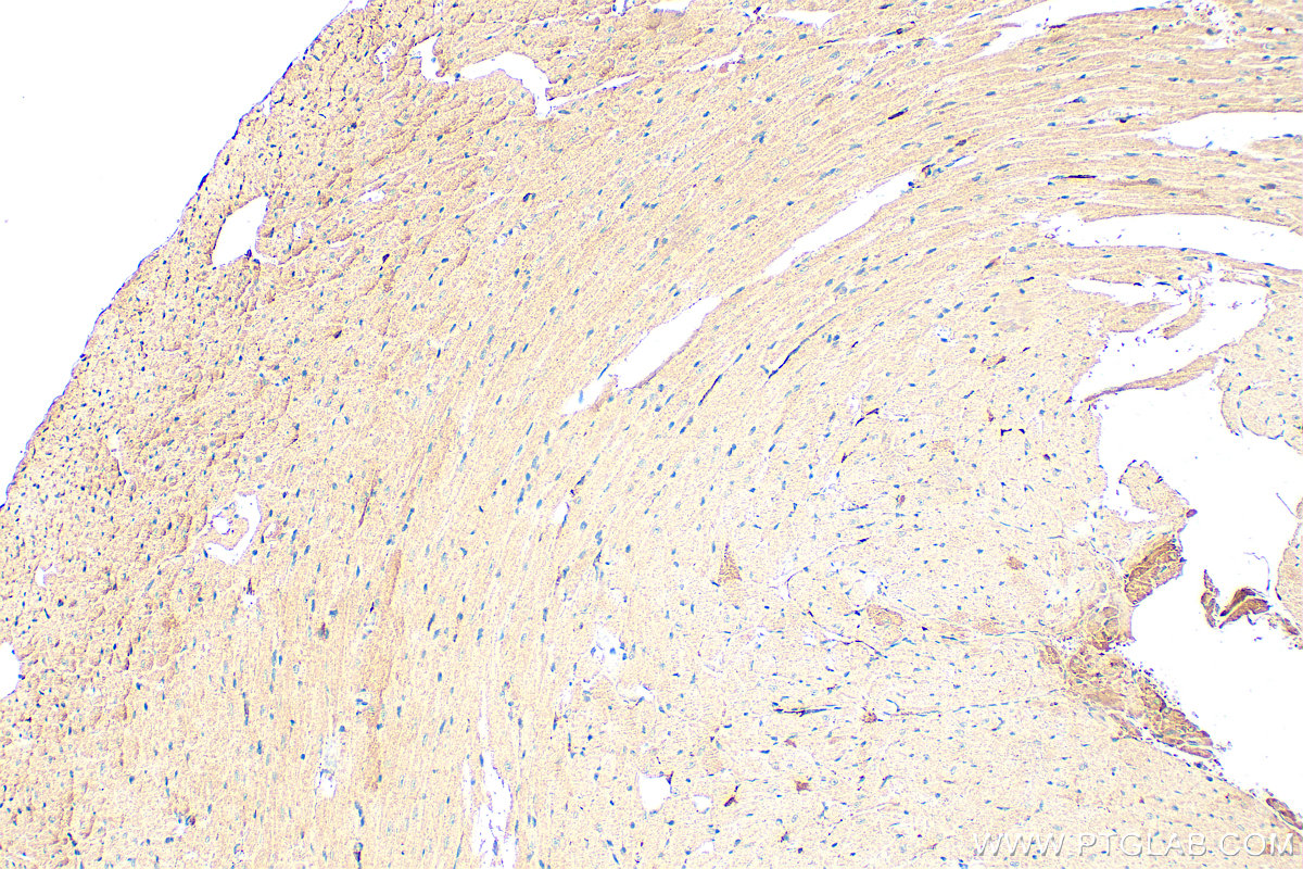 IHC staining of mouse heart using 20467-1-AP