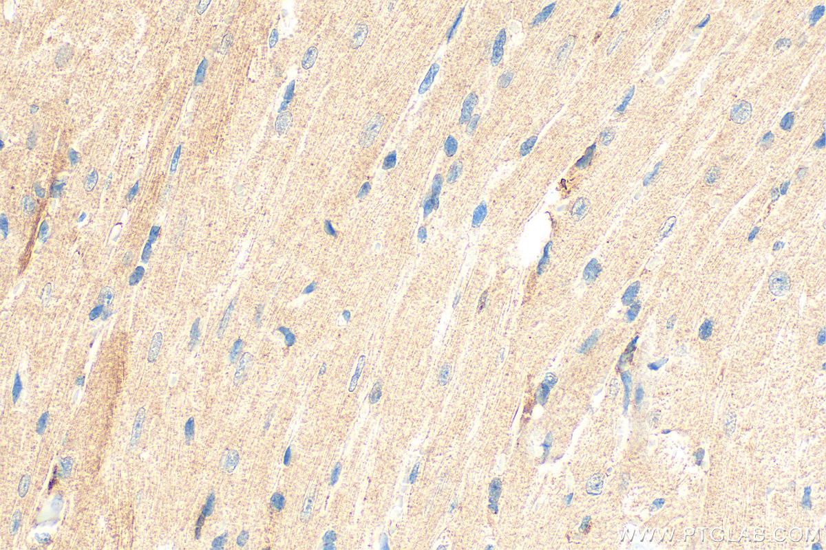 IHC staining of mouse heart using 20467-1-AP