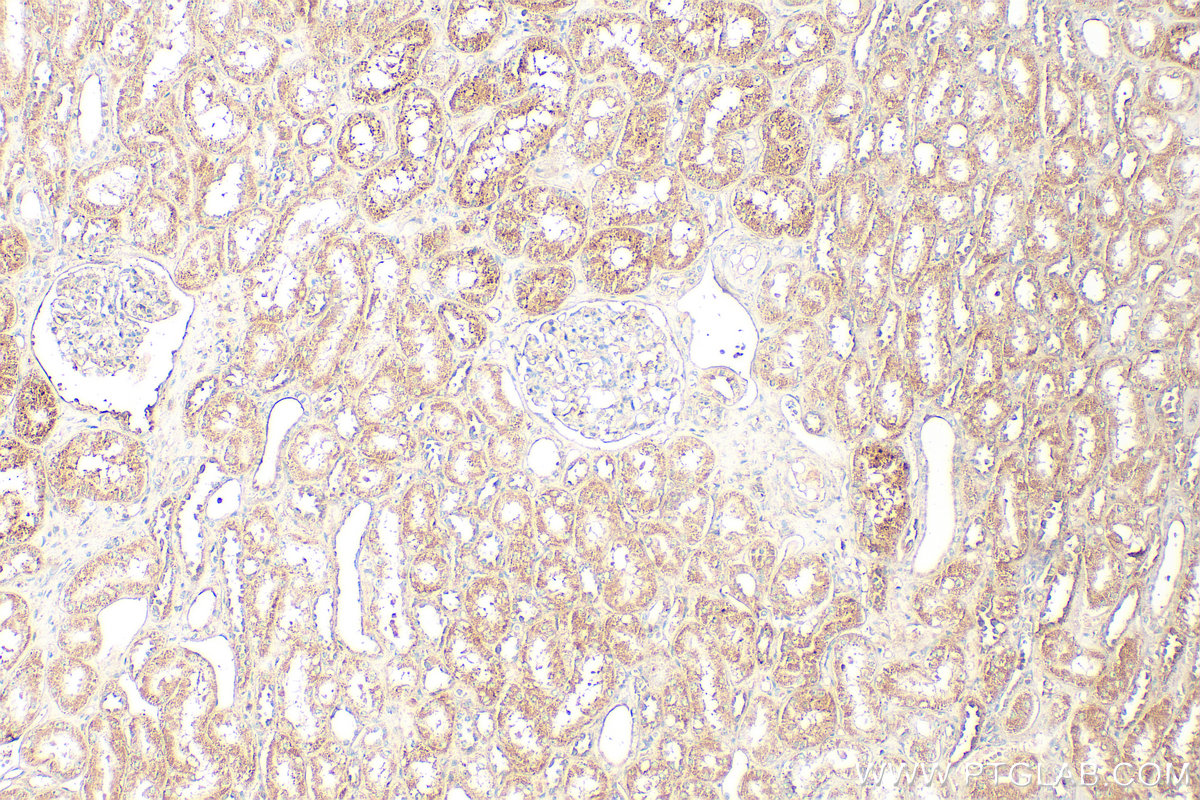 IHC staining of human kidney using 20467-1-AP