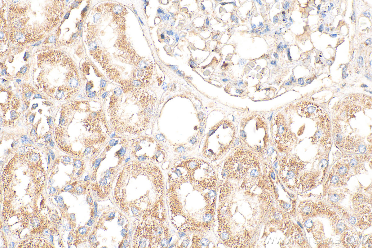 IHC staining of human kidney using 20467-1-AP