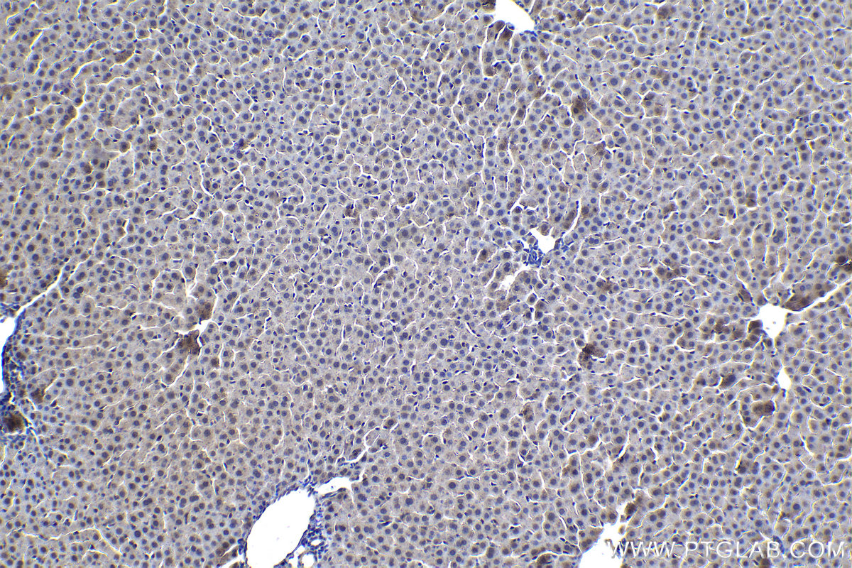 IHC staining of rat liver using 20663-1-AP (same clone as 20663-1-PBS)