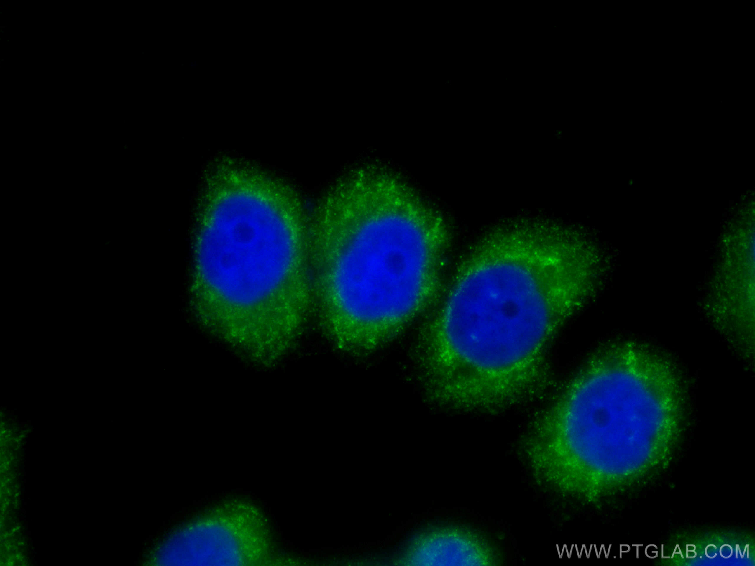 Stanniocalcin 2