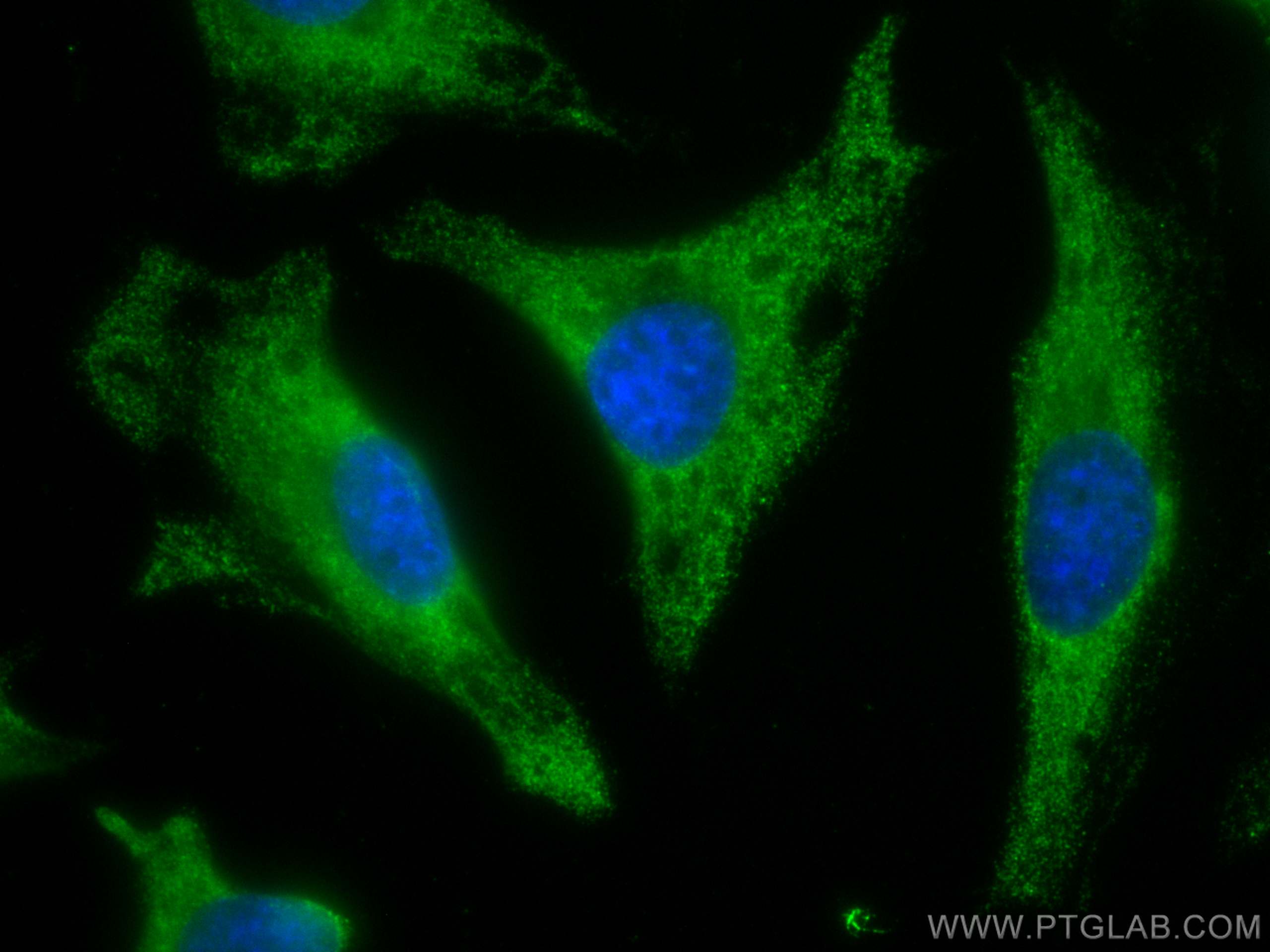 IF Staining of HeLa using CL488-60063