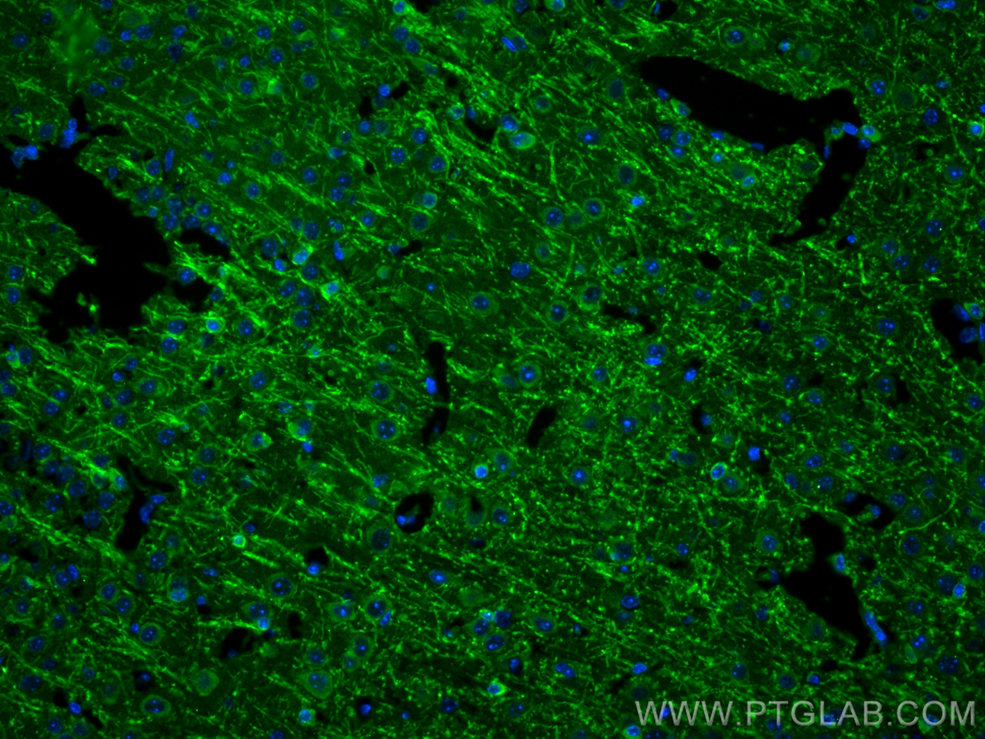 IF Staining of mouse brain using 82559-1-RR