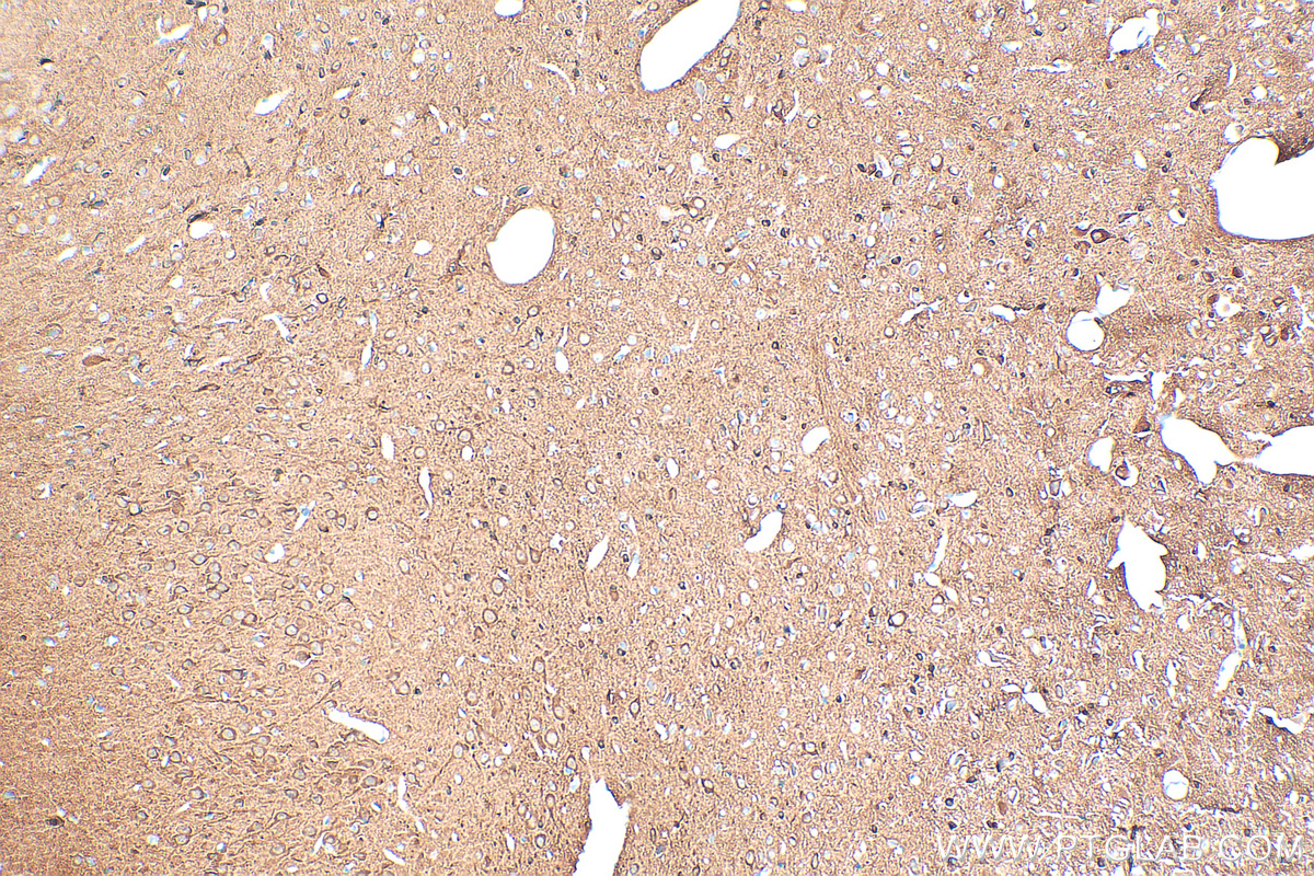 IHC staining of rat brain using 82559-1-RR