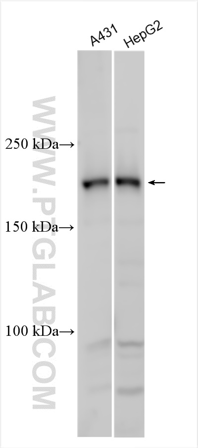 WB analysis using 27524-1-AP