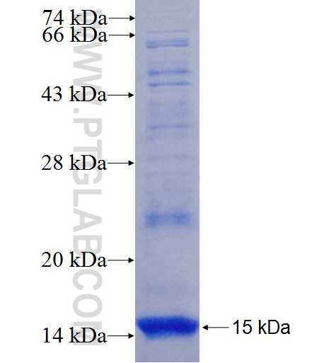Supervillin fusion protein Ag26201 SDS-PAGE Supervillin fusion protein Ag26201 SDS-PAGE