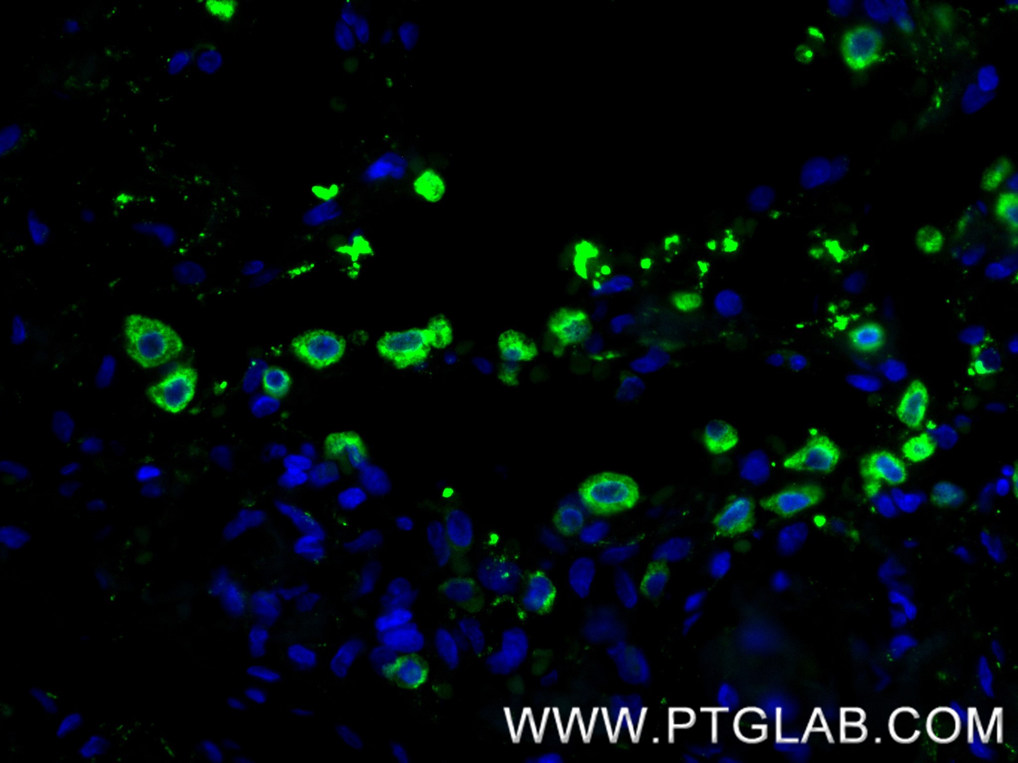 IF Staining of human lung using 86322-1-RR IF Staining of human lung using 86322-1-RR