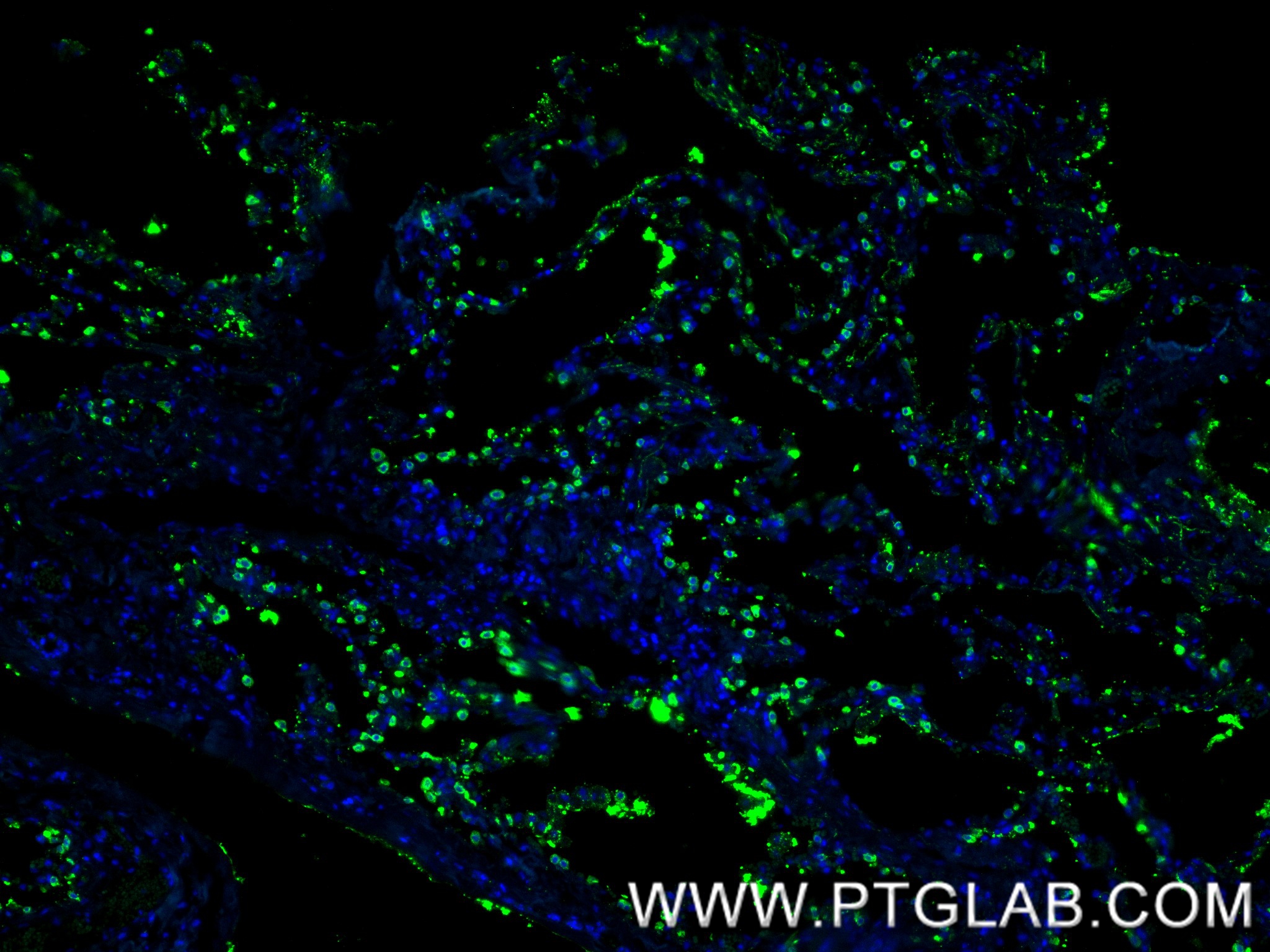 IF Staining of human lung using 86322-1-RR IF Staining of human lung using 86322-1-RR