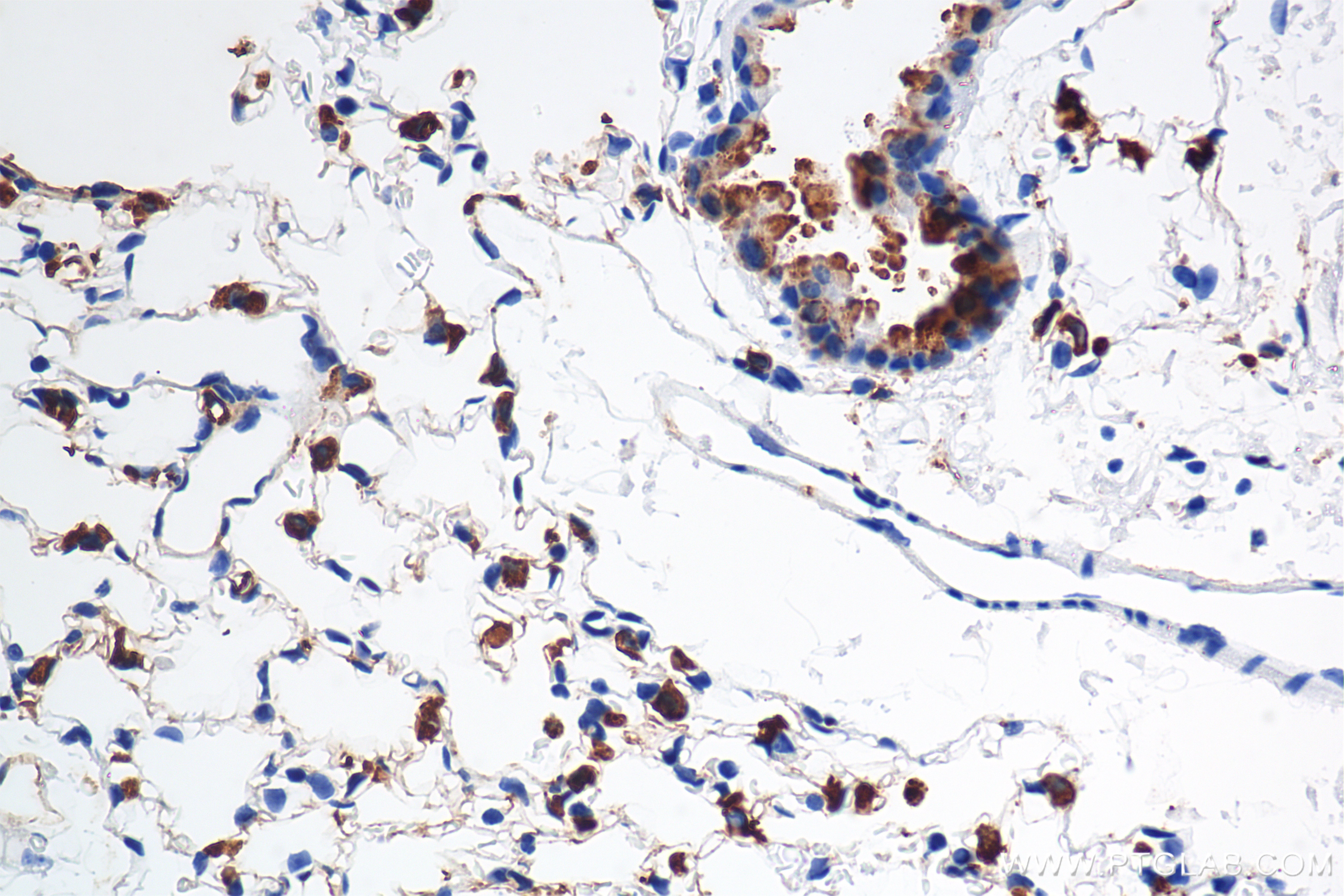 IHC staining of mouse lung using 86322-1-RR IHC staining of mouse lung using 86322-1-RR