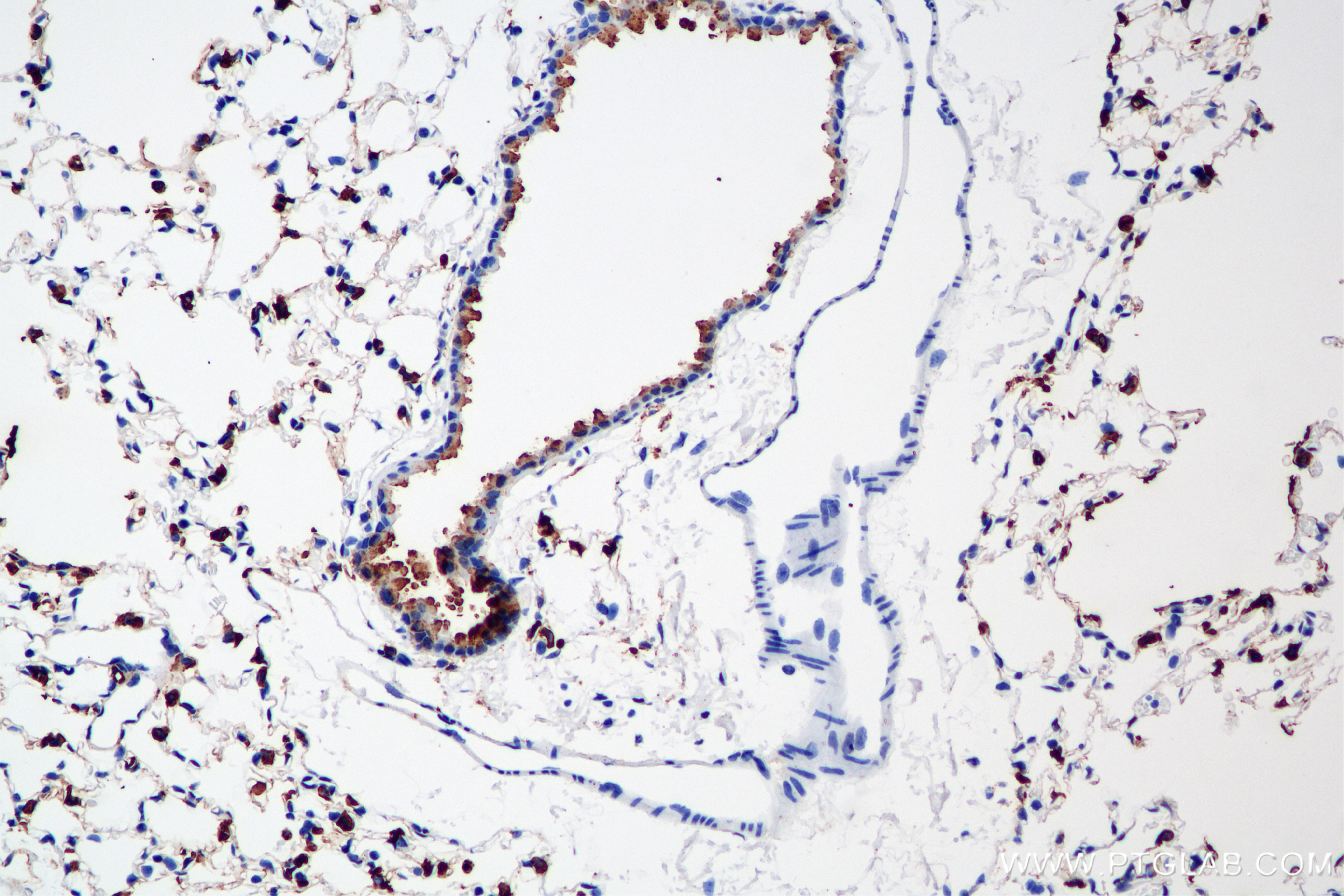 IHC staining of mouse lung using 86322-1-RR IHC staining of mouse lung using 86322-1-RR