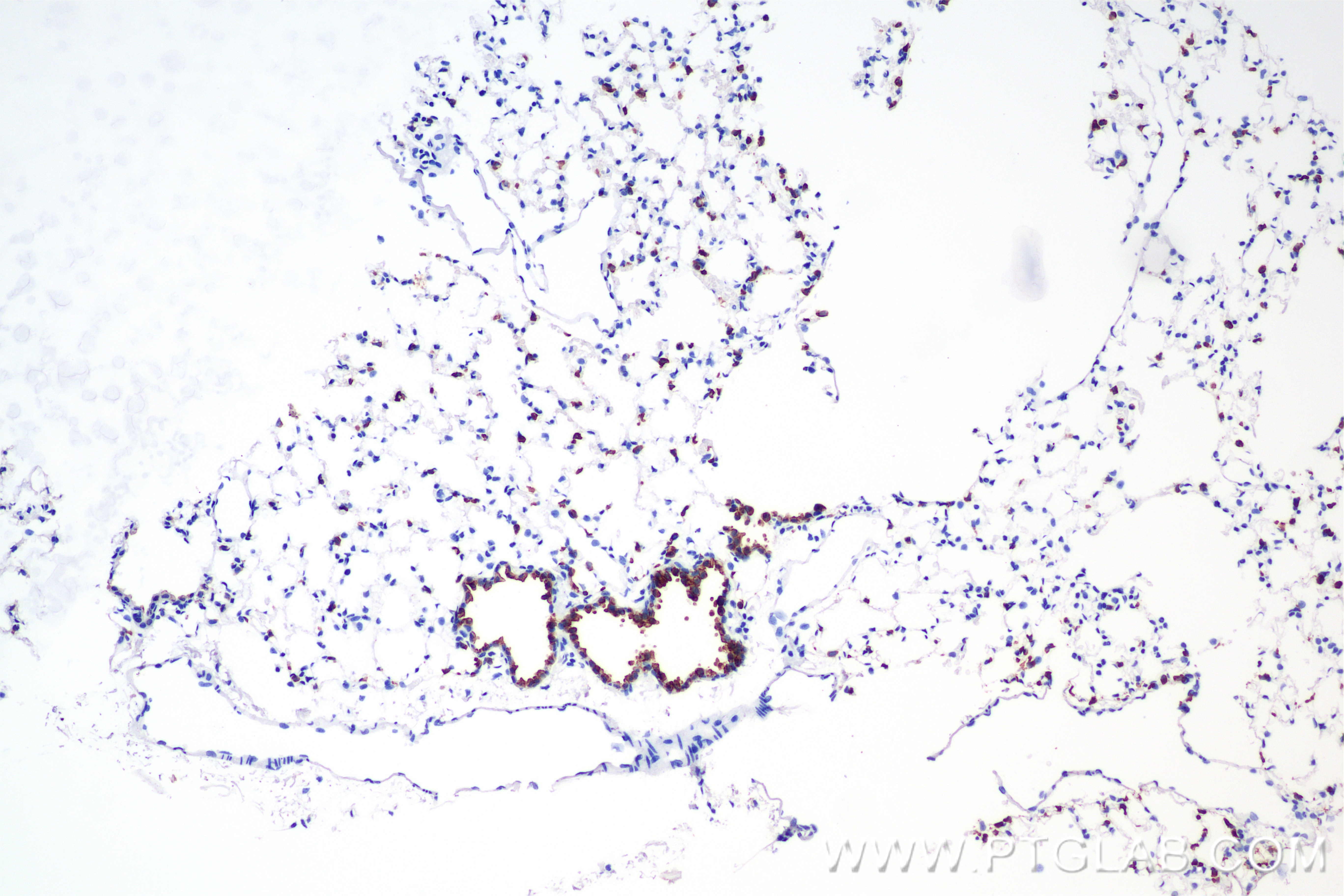IHC staining of mouse lung using 85985-1-RR