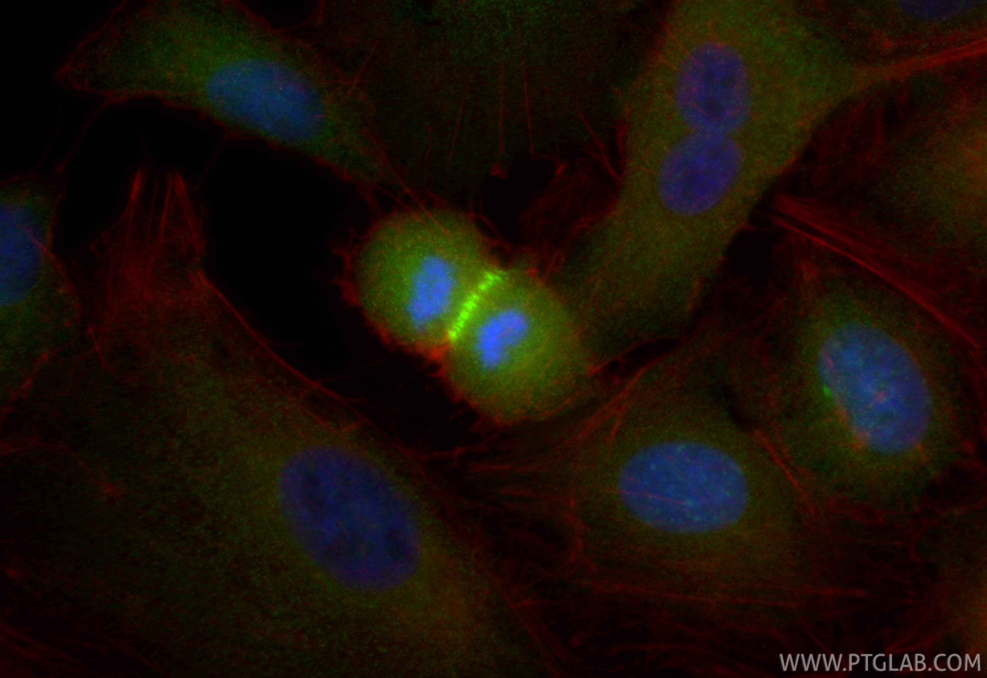 IF Staining of A549 using 98624-1-RR (same clone as 98624-1-PBS)