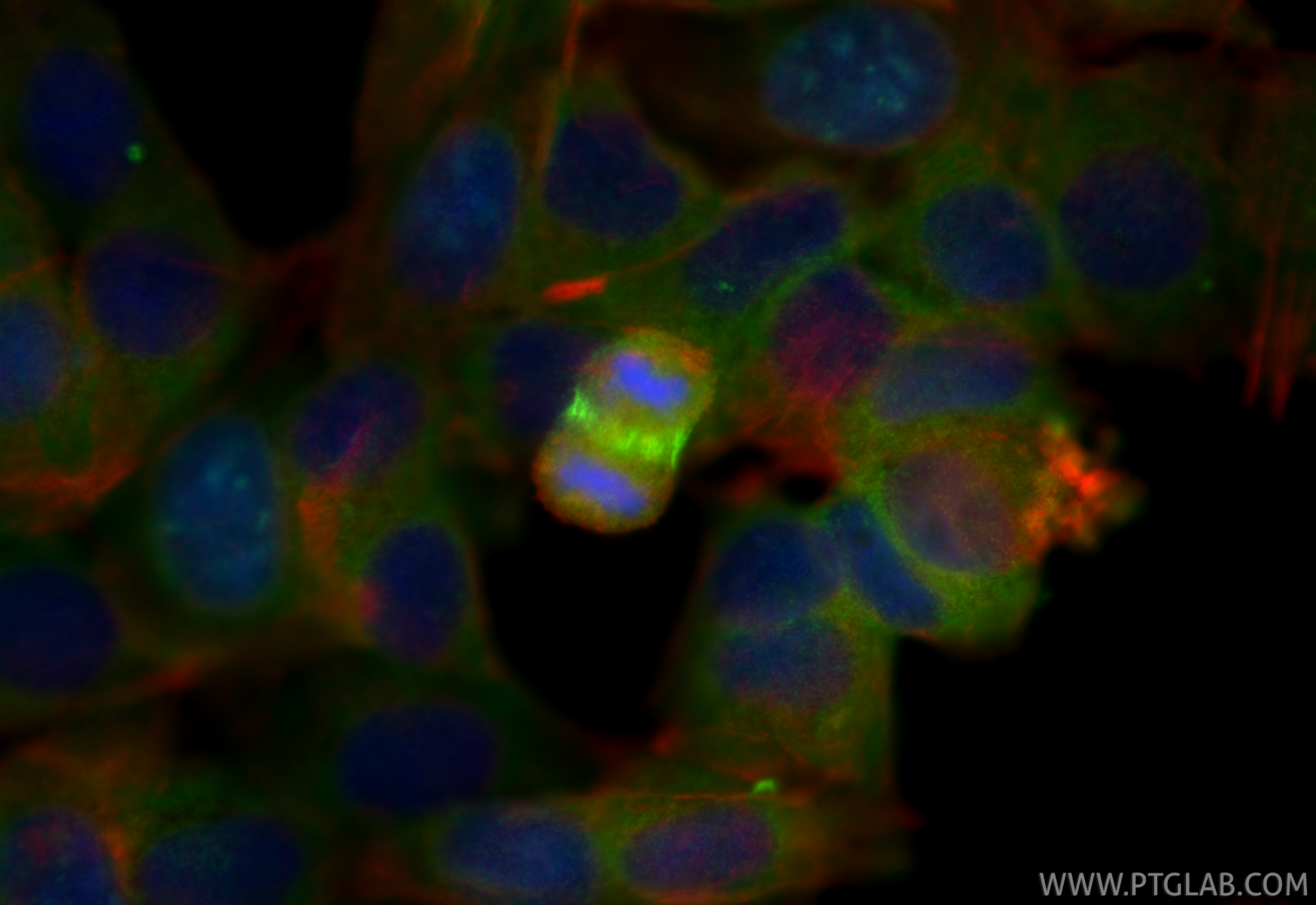 IF Staining of MCF-7 using 98624-1-RR (same clone as 98624-1-PBS)