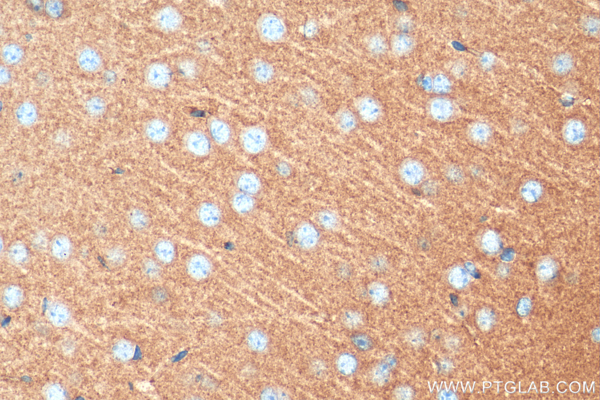 IHC staining of mouse brain using 29734-1-AP