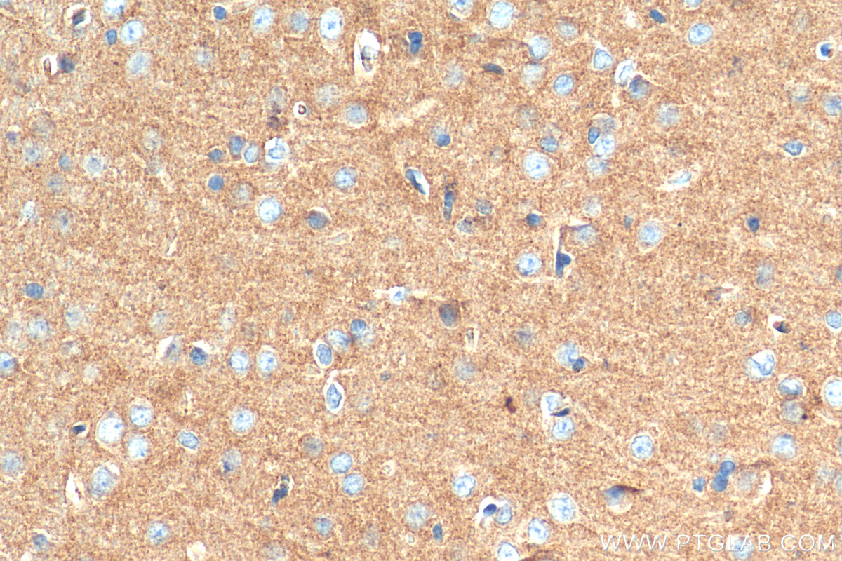 IHC staining of rat brain using 29734-1-AP