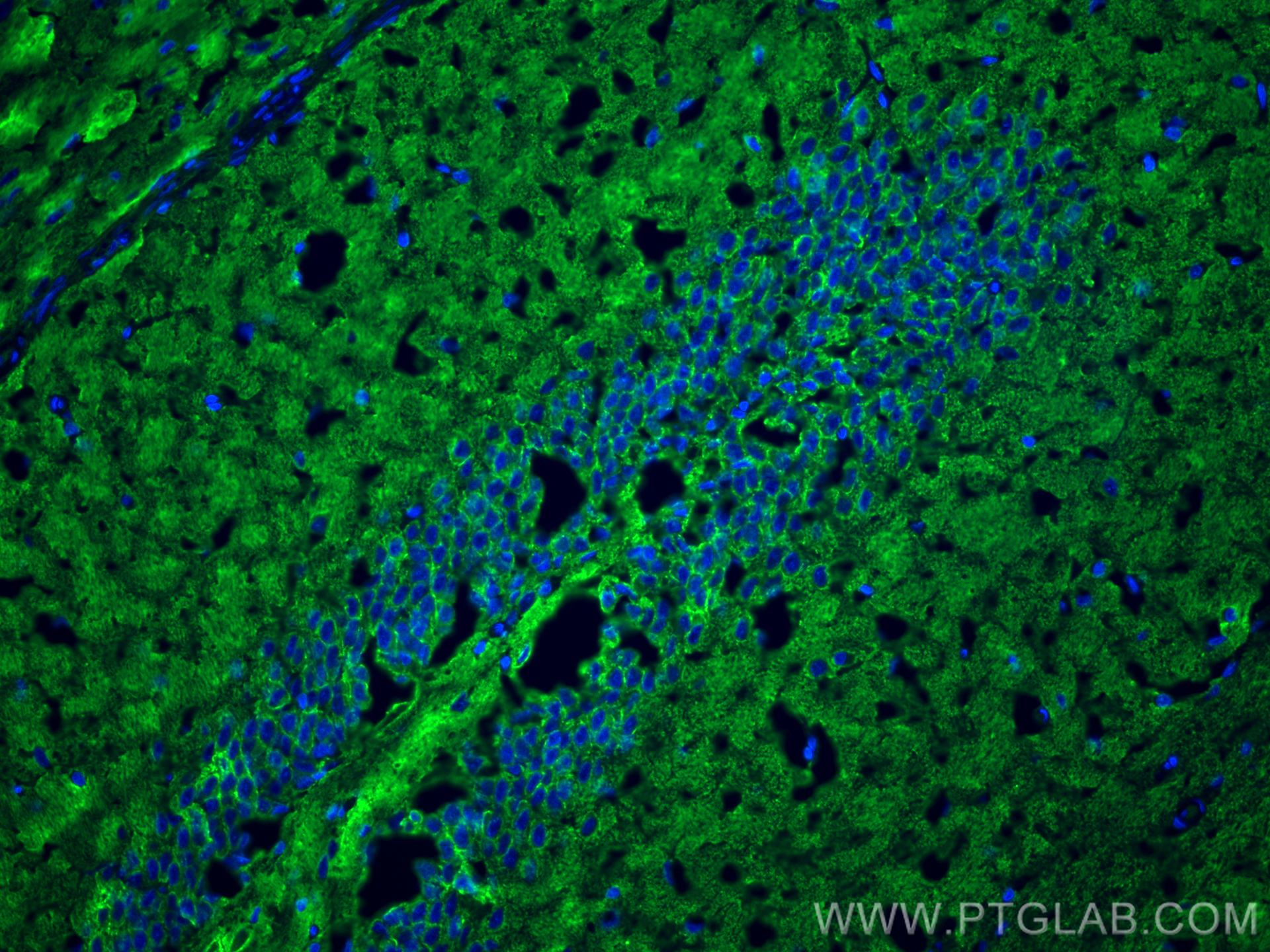 IF Staining of rat brain using 67864-1-Ig