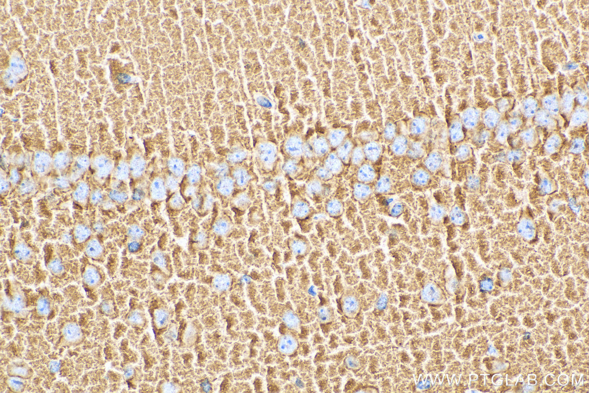 IHC staining of mouse brain using 67864-1-Ig