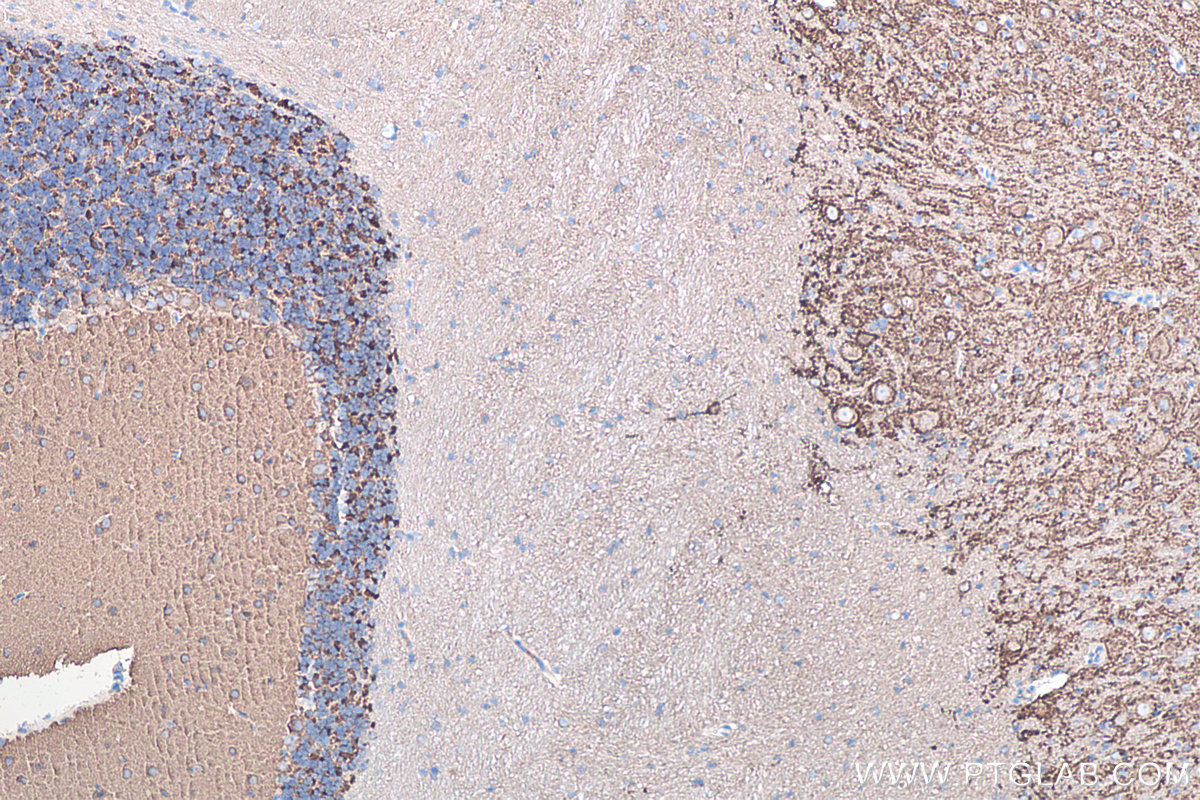 IHC staining of rat cerebellum using 67864-1-Ig