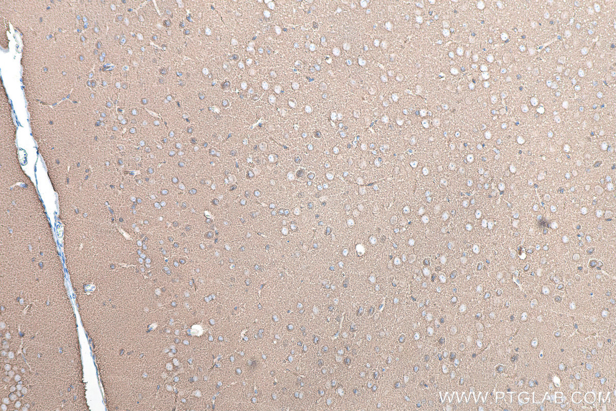 IHC staining of mouse brain using 67864-1-Ig