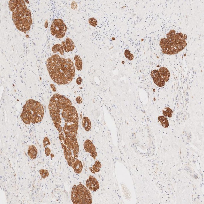 IHC staining of human pancreas using 67864-1-Ig