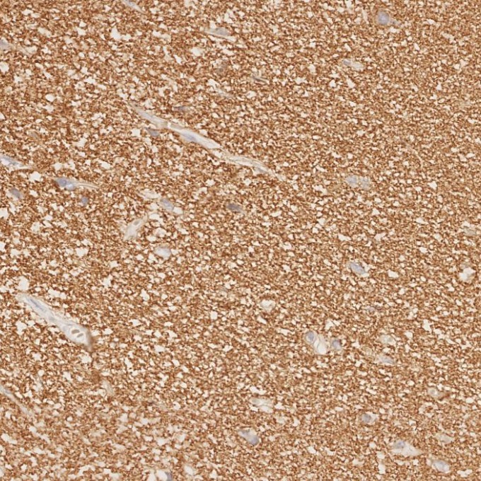 IHC staining of human brain using 67864-1-Ig