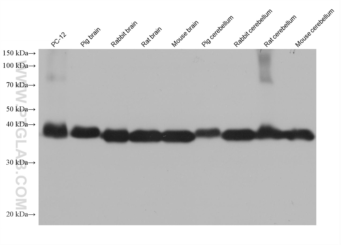 WB analysis using 67864-1-Ig