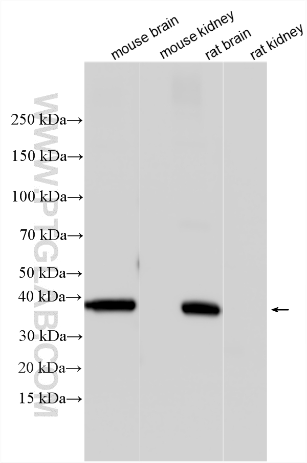 WB analysis using 67864-1-Ig
