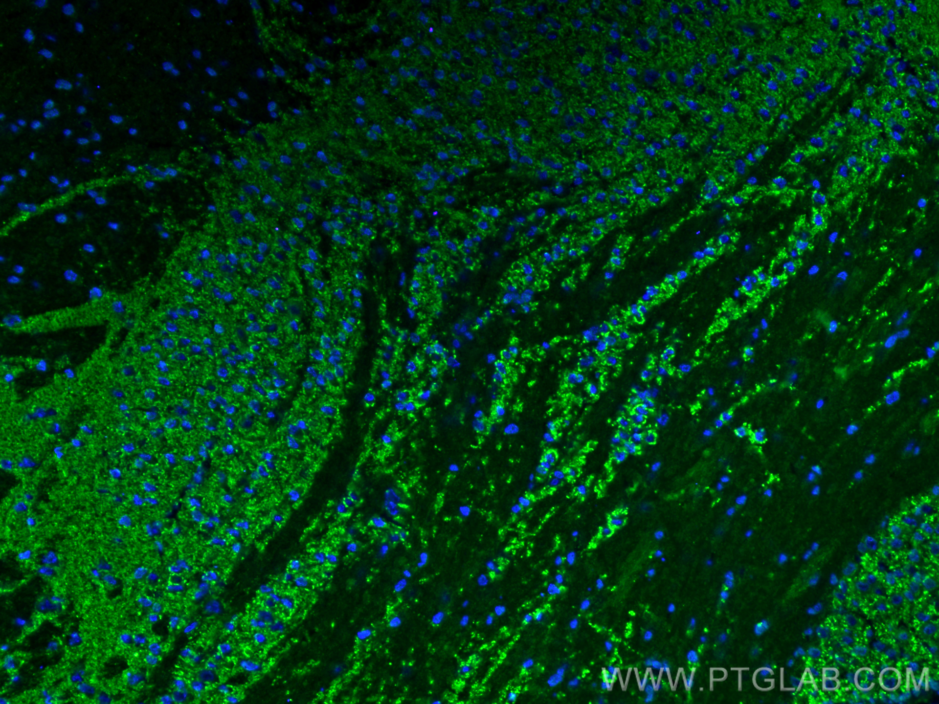 IF Staining of mouse brain using 82900-1-RR