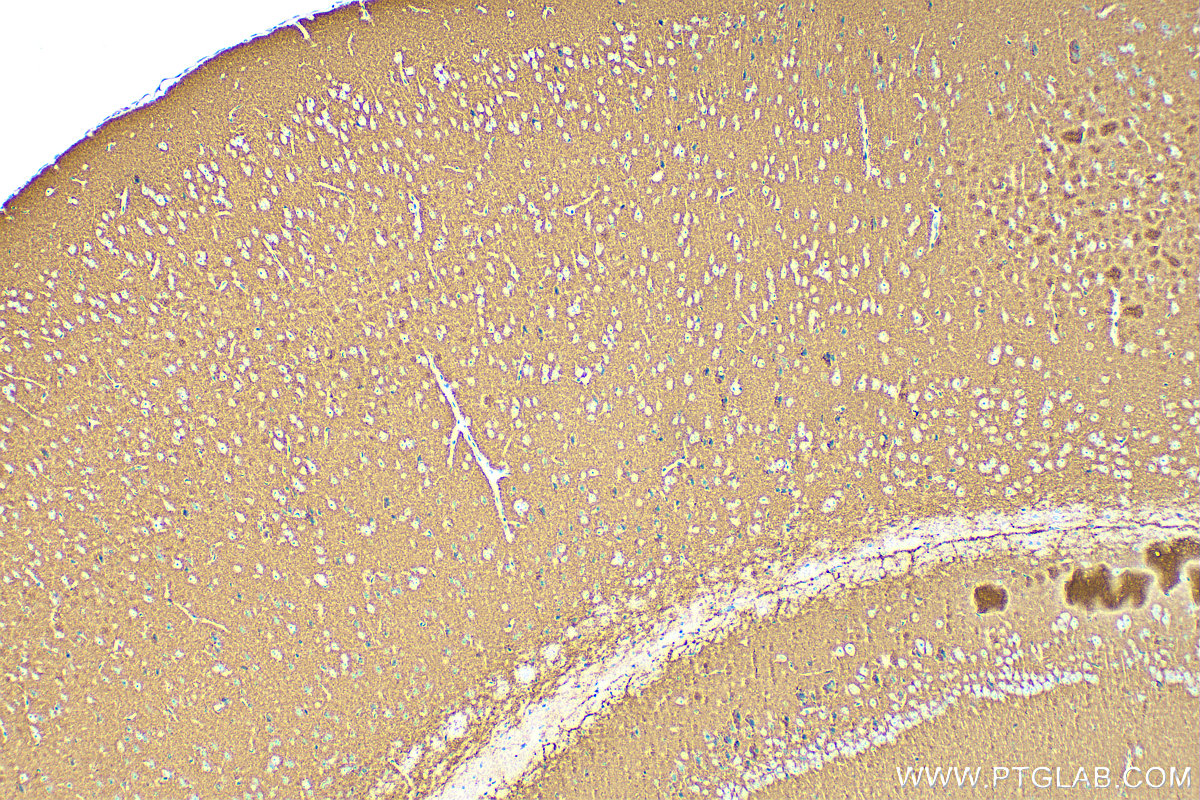 IHC staining of mouse brain using 82900-1-RR