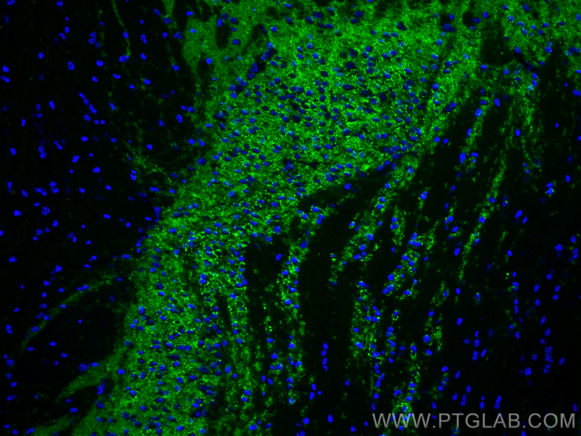 IF Staining of mouse brain using CL488-82900