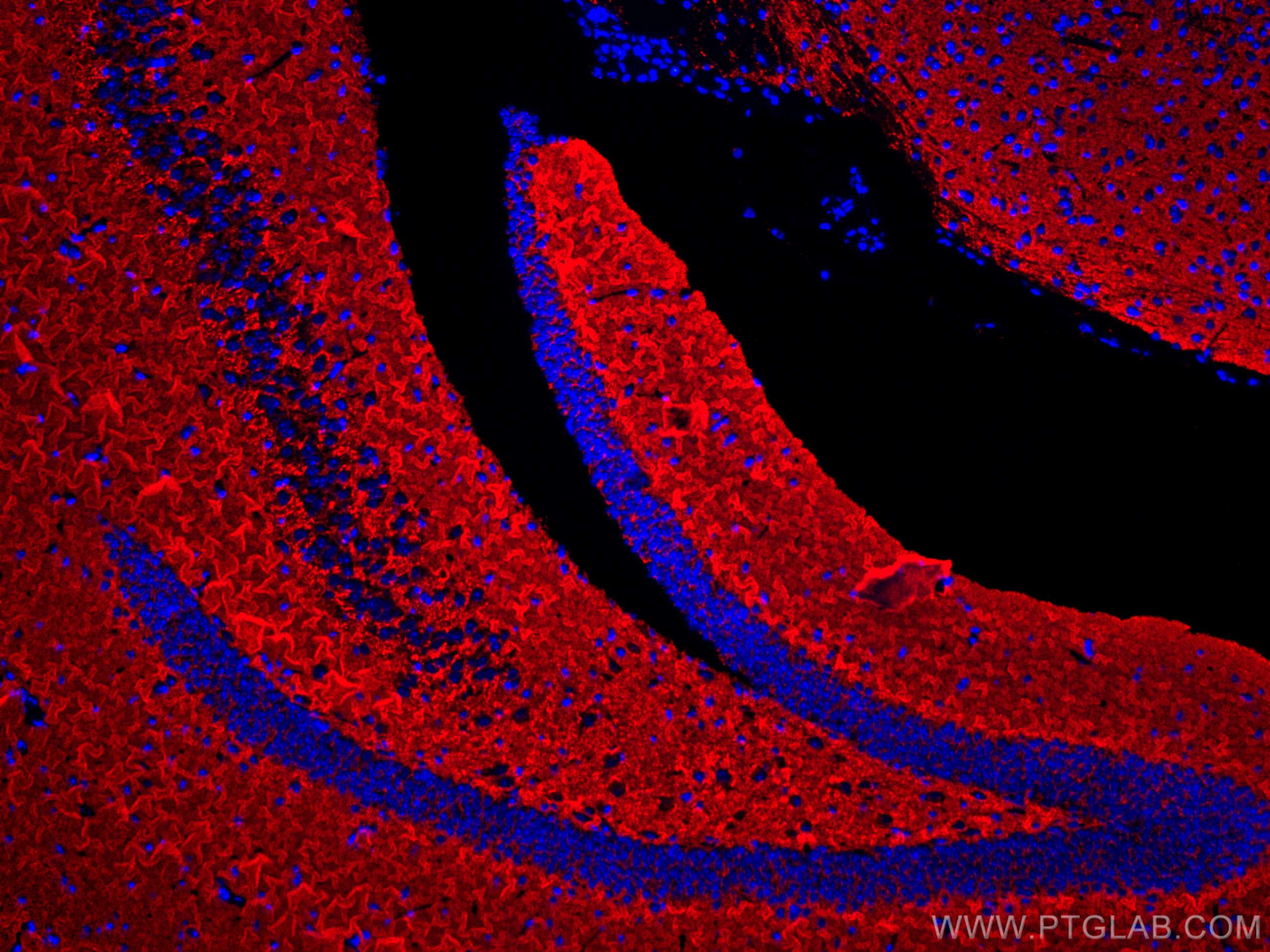 Synaptophysin